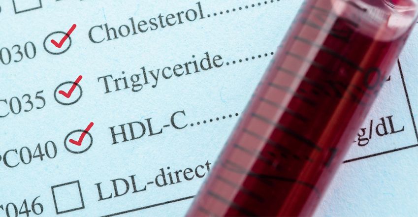 LDL, HDL: minden, amit a koleszterinről és a vérzsírról tudnod kell